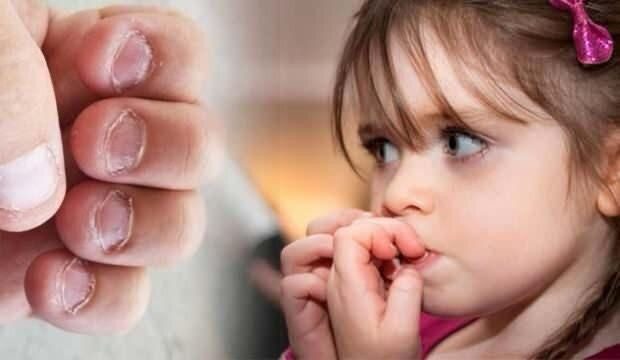 Uşaqlarda bu davranışların arxasındakı psixoloji səbəblər nədir? 